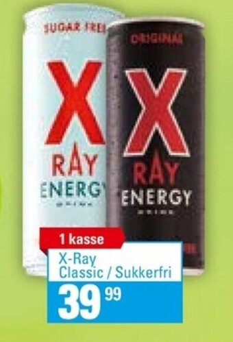 X-Ray Classic/ Sukkerfri