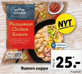 Ramen Suppe 400g