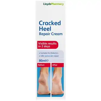 Lloyds Pharmacy Lloydspharmacy cracked heel repair cream offer