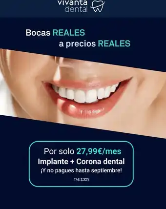 Vivanta Vivanta dental bocas reales a precios reales por solo 27,99€/mes implante + corona dental ¡y no pagues hasta septiembre! oferta