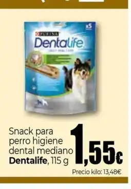 Unide Supermercados DENTALIFE Snack para perro higiene dental mediano oferta