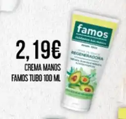 Claudio Crema manos famos tubo oferta