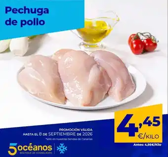 Pechuga de pollo