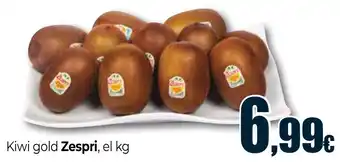 Kiwi gold Zespri