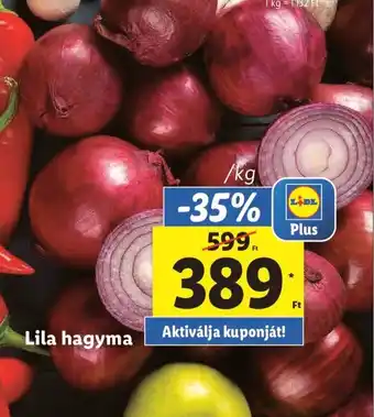 Lila hagyma /kg