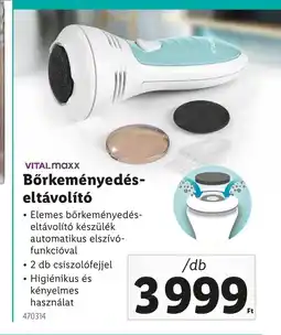 Lidl VITAL maxx Bőrkeményedés- eltávolító ajánlat