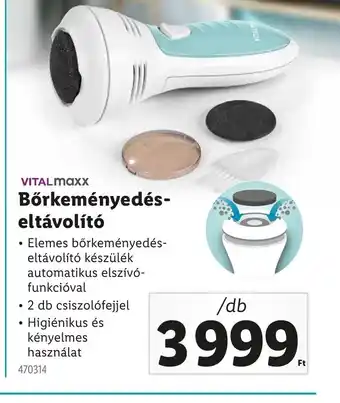 Lidl Vitalmaxx Bőrkeményedés-eltávolít ajánlat