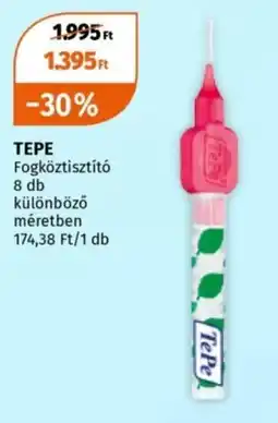 Müller Tepe fogköztisztító ajánlat
