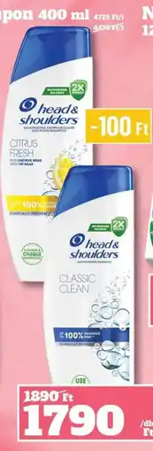 Vil-For head & shoulders ajánlat