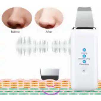 Fandeal Limpiador facial ultrasónico 3en1 con accesorio para el acné oferta