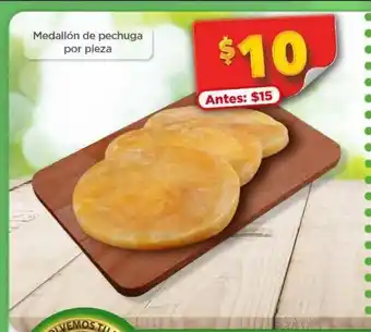 Medallon de pechuga por pieza