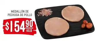 Soriana Híper Medallón de Pechuga de Pollo oferta