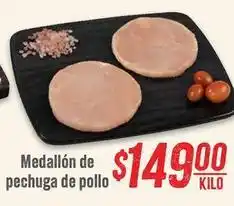 Soriana Híper Medallón de pechuga de pollo oferta