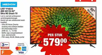 ALDI Medion Life P16510 (MD 30115) 65 aanbieding