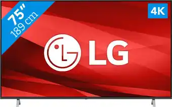 Coolblue LG 75UP77006LB (2021) aanbieding