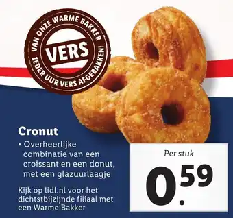 Lidl Cronut aanbieding