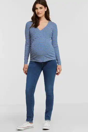 Wehkamp Only maternity skinny zwangerschapsjeans olmroyal met biologisch katoen stonewashed aanbieding