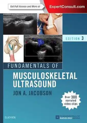 Bol.com Fundamentals of Musculoskeletal Ultrasound aanbieding