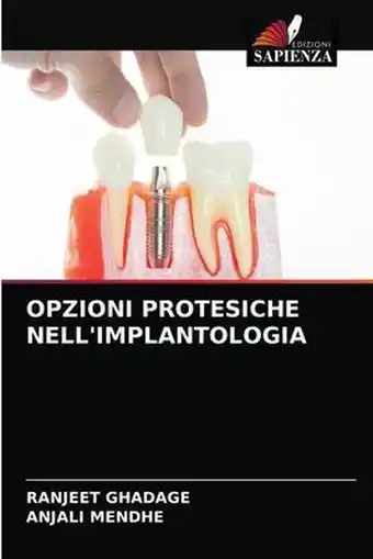 Bol.com Opzioni Protesiche Nell'implantologia aanbieding