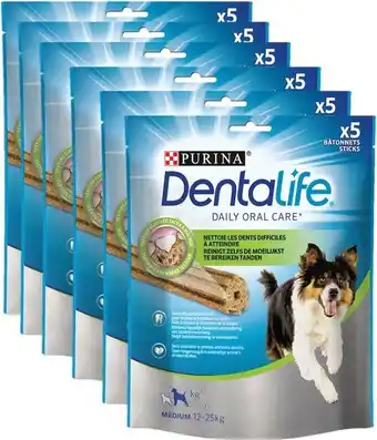 Bol.com Dentalife Daily Oral Care Medium - Hondensnacks - Kip - 6 x 115 g aanbieding