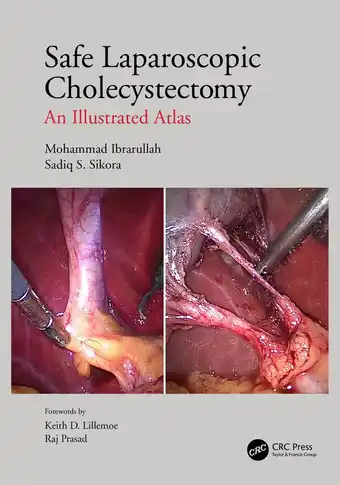 Bol.com Safe Laparoscopic Cholecystectomy aanbieding