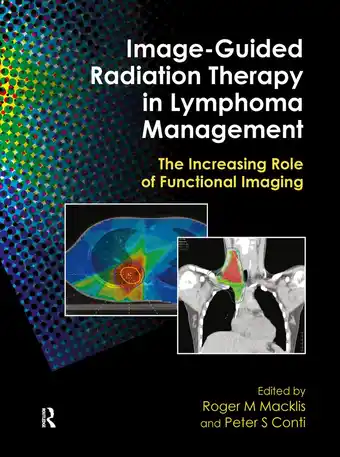 Bol.com Image-Guided Radiation Therapy in Lymphoma Management aanbieding