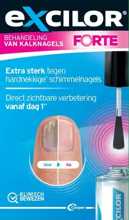 De Online Drogist Excilor Forte Kalknagel Behandeling aanbieding