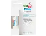 De Online Drogist Sebamed Anti-Pimple Gel aanbieding