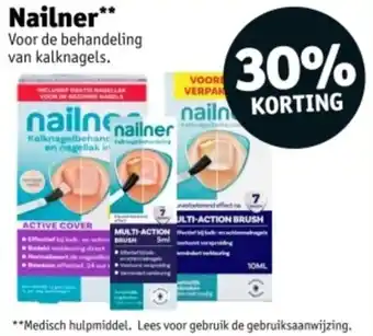 Kruidvat Nailner aanbieding