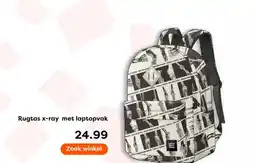 The Read Shop Rugtas x-ray met laptopvak aanbieding