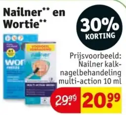 Kruidvat Nailner en Wortie aanbieding