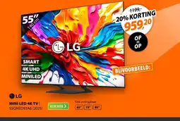 Expert LG MINI LED EVO 55QNED93A6 (2025) aanbieding
