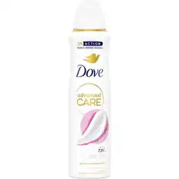 Etos Dove Advanced Care Soft Feel Anti-Transpirant Deodorant Spray 150 ML aanbieding