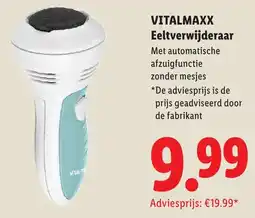 Lidl Vitalmaxx Eeltverwijderaar aanbieding