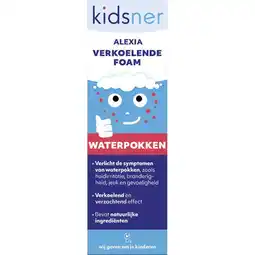 Etos Kidsner Alexia De Verkoelende Foam Bij Waterpokken 100 ML aanbieding