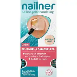 Trekpleister Nailner Behandel & Camoufleer Kalknagelbehandeling aanbieding