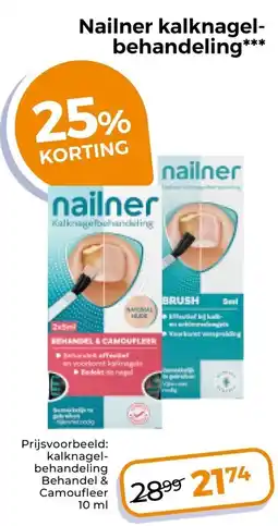 Trekpleister Nailner kalknagel-behandeling aanbieding