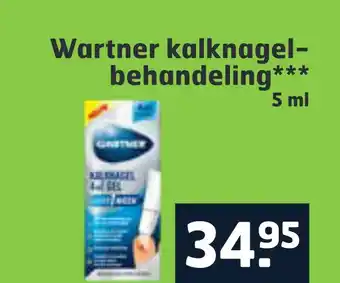 Trekpleister Wartner kalknagelbehandeling aanbieding