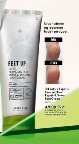 Oriflame Feet Up Expert / Cracked Heel Repair & Smooth Foot Cream tilbud