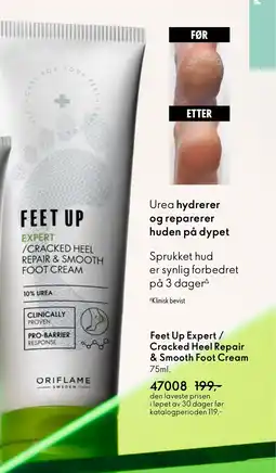 Oriflame Feet Up Expert/ Cracked Heel Repair & Smooth Foot Cream tilbud