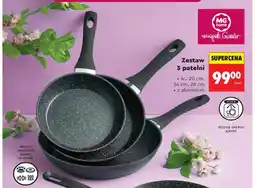 Biedronka Zestaw 3 patelni MG home śr. 20cm 24cm 28cm z aluminium oferta
