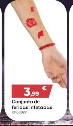 Toys R Us Conjunto de feridas infetadas promoção