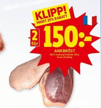 Ankbröst