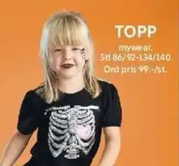 Topp