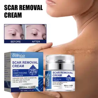 Walmart Yatlte Clearance Scar Removal Cream Scar Repair Cream Scar Removal And Skin Repair 50ml offer