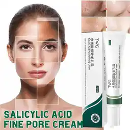 Walmart YUEYAN 20 Salicylic Acid Cream for Effective Acne Removal offer