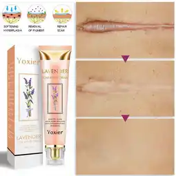 Walmart YUEYAN 20g Lavender Scar Repair Cream Treats Acne Spots and Restores Skins Na offer