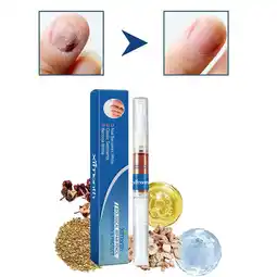 Walmart GHYJPAJK 3ml Finger Fungus Repair Pen offer