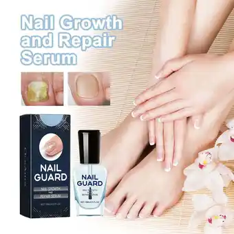 Walmart YUEYAN Onyxoguard Nail Growth Repair Serum Onyxoguard Nail Growth StrengthenerUS NEW offer