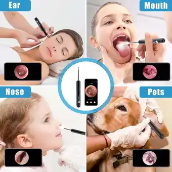 Walmart Ear Wax Removal Tool Camera, Upgrade Ear Wax Removal Tool for iOS and Android (Black) offer